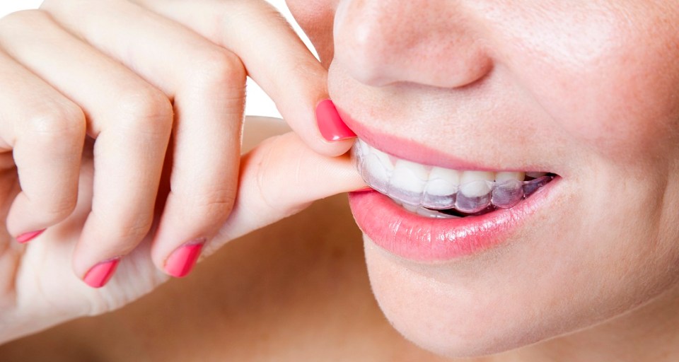 How to Make DIY Braces Out of Dental Floss?